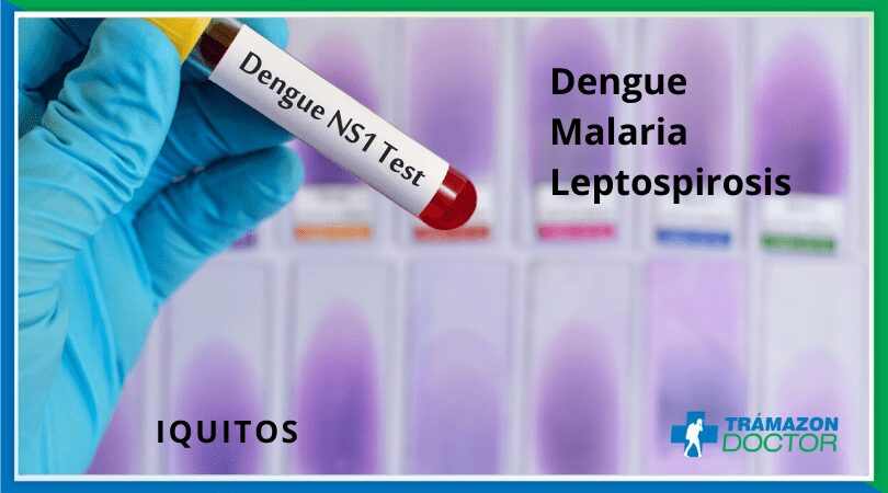 Fiebre en Iquitos: 4 claves para evitar muertes por dengue y leptospirosis