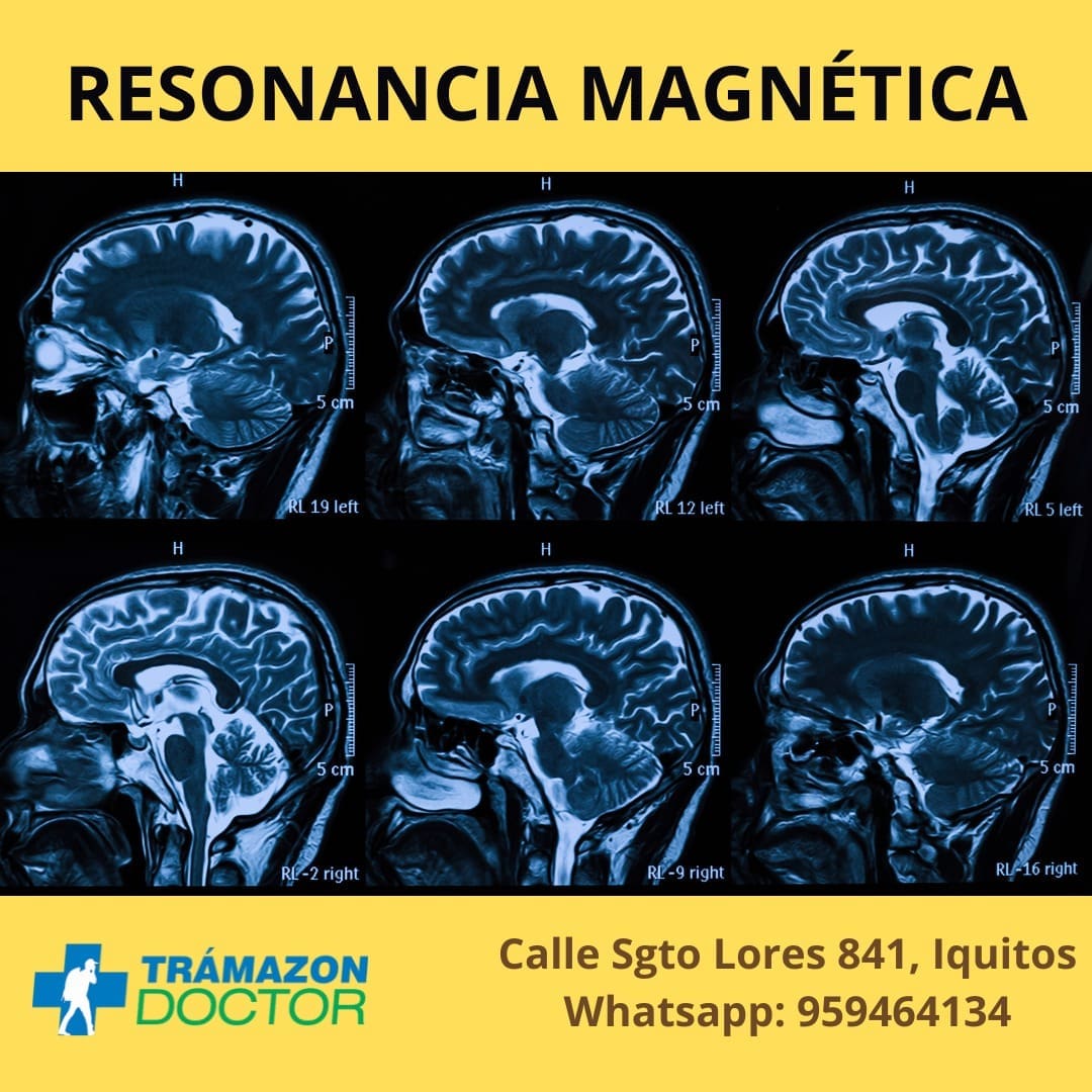 resonancia magnética iquitos